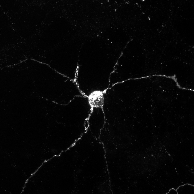 A white neuron on black 