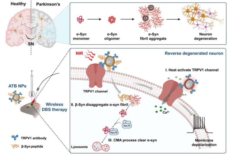 Nanoparticle-based wireless deep brain stimulation system revealed to reverse Parkinson's disease