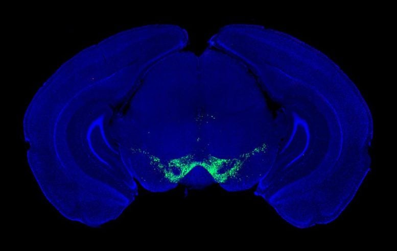 Midbrain Dopamine Producing Neurons