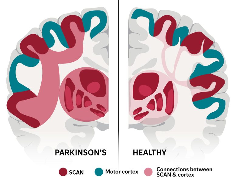 SCAN Parkinson's Healthy Brain
