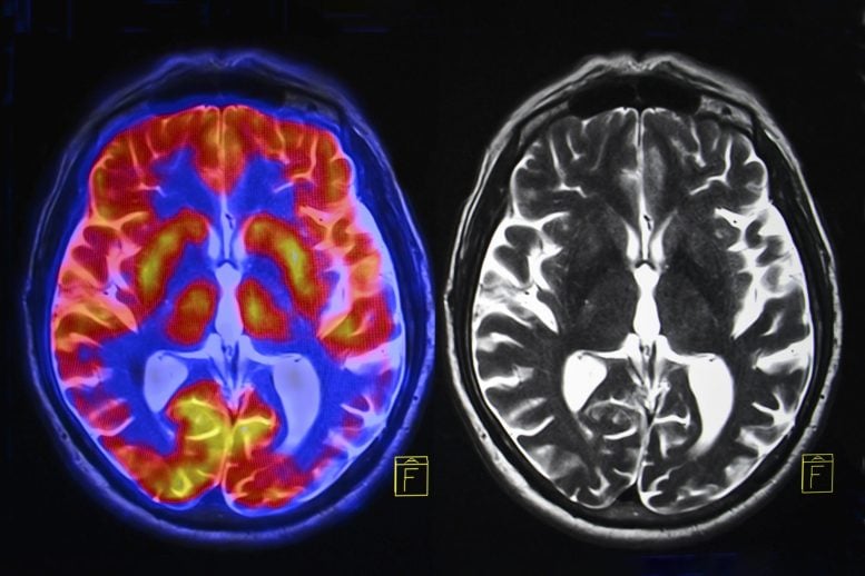 Color Black White Brain Scans