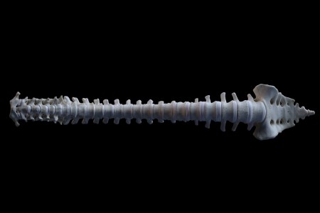 A Spinal Implant Helped a Parkinson’s Patient Walk Several Miles